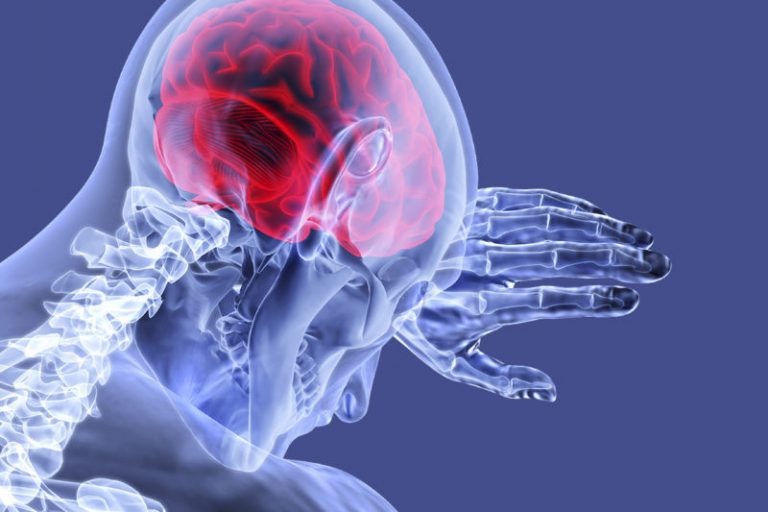 EVERYTHING YOU NEED TO KNOW ABOUT CEREBELLAR ATROPHY