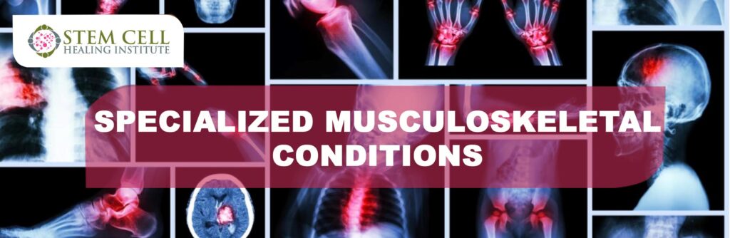 Specialized Musculoskeletal