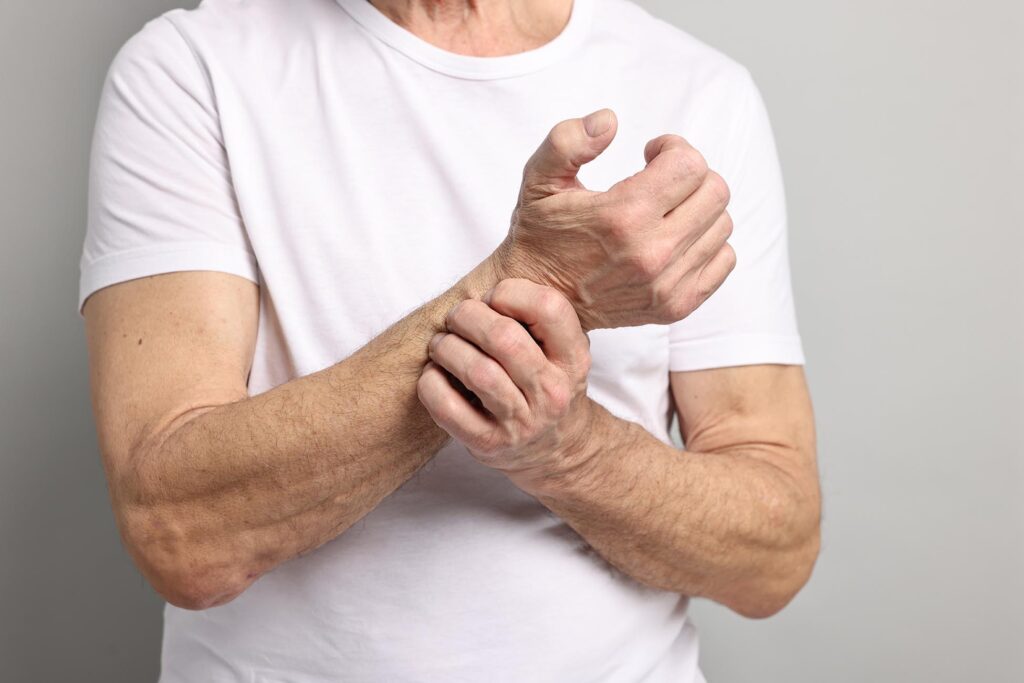 stem cell therapy for arthritis